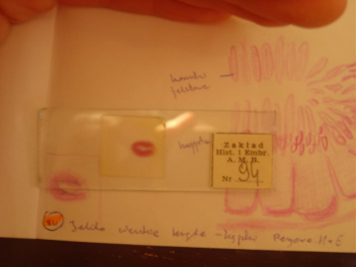 93) jelito cienkie krete