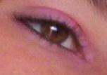 my eye